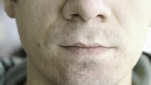 Как бороться с раздражением после бритья: рабочие советы