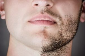 Как навсегда избавиться от раздражения на лице после бритья? -